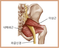 MRI