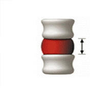 Spinal Decompression IDP = -150 mmGg Disc height : 7mm 증가